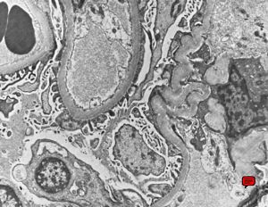 M,67y. | normal kidney M,67y. | normal kidney